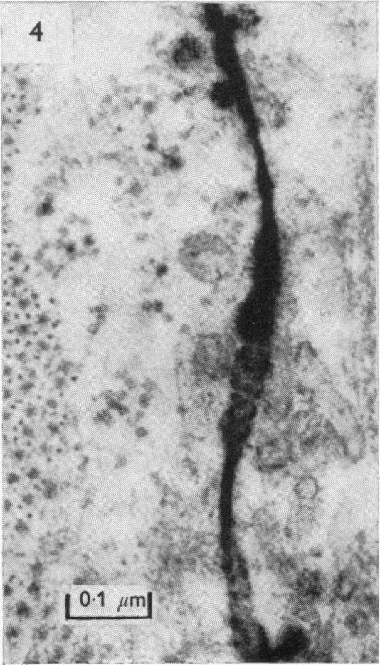 https://cdn.ncbi.nlm.nih.gov/pmc/blobs/9269/1330728/ecd86f187f59/jphysiol00916-0089-d.jpg