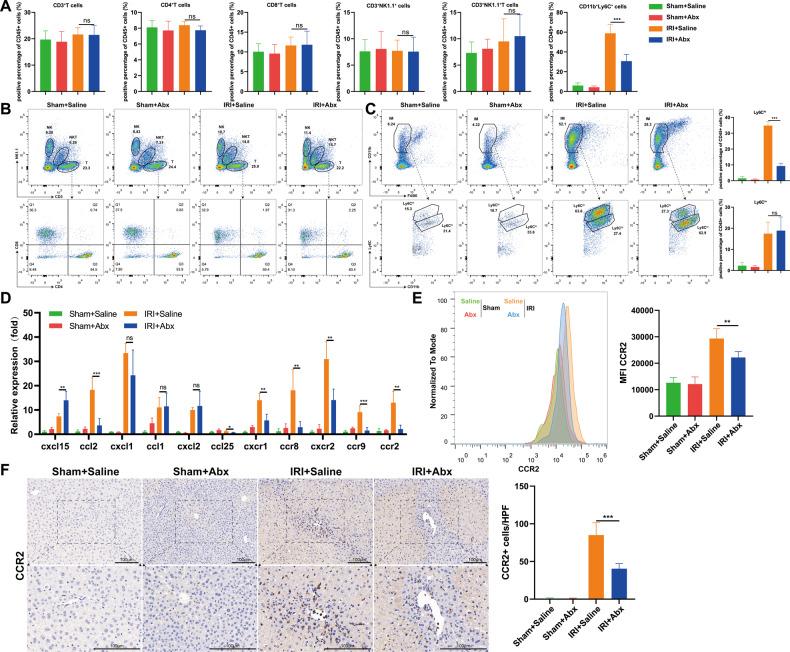 https://cdn.ncbi.nlm.nih.gov/pmc/blobs/9269/9124217/42567b20f61b/41419_2022_4955_Fig2_HTML.jpg