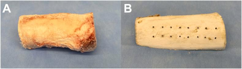 https://cdn.ncbi.nlm.nih.gov/pmc/blobs/926c/12275869/dc510dc3cdd7/gr2.jpg