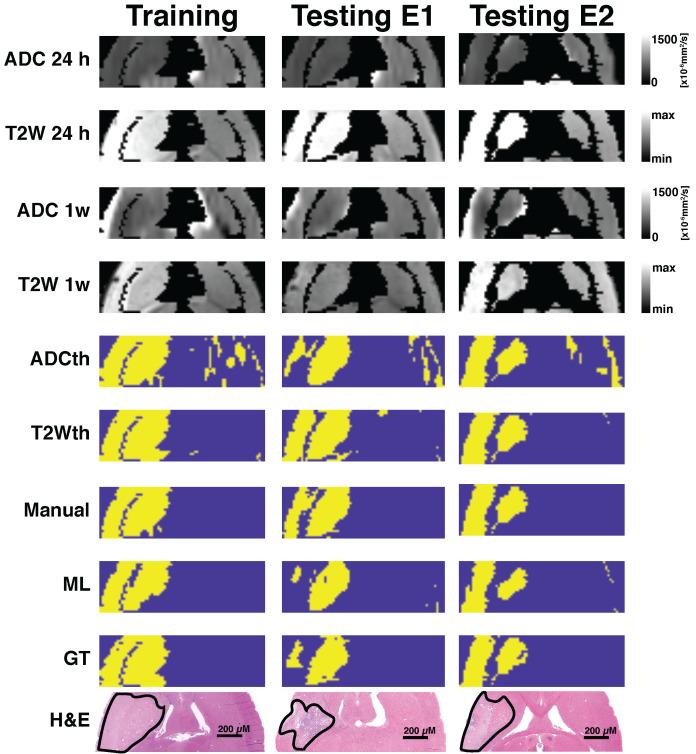 https://cdn.ncbi.nlm.nih.gov/pmc/blobs/9275/7806470/206271214768/thnov11p3017g005.jpg