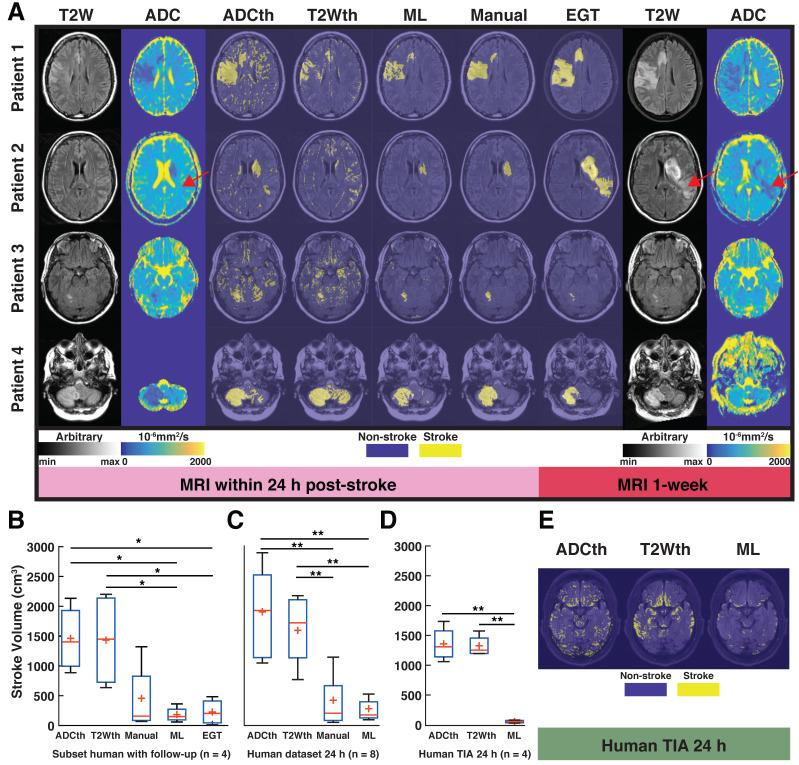 https://cdn.ncbi.nlm.nih.gov/pmc/blobs/9275/7806470/500ab59b98b1/thnov11p3017g007.jpg