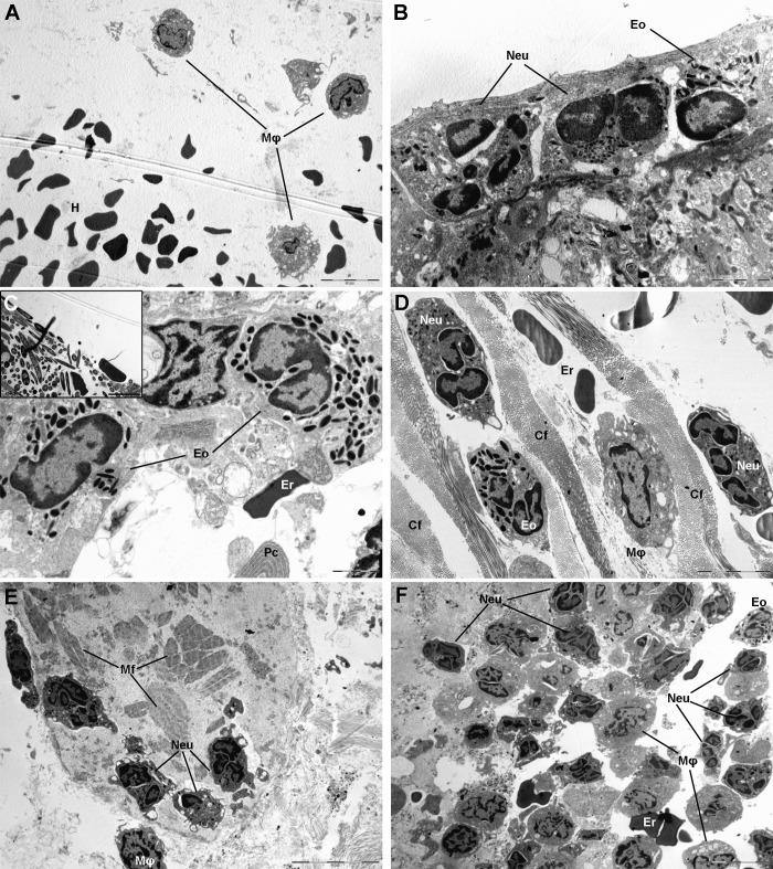 https://cdn.ncbi.nlm.nih.gov/pmc/blobs/9278/6538193/0b96cf9229ae/pntd.0007397.g005.jpg