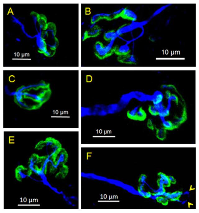 https://cdn.ncbi.nlm.nih.gov/pmc/blobs/927a/11728458/167a573acc76/toxins-16-00506-g006.jpg