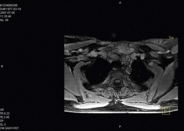 https://cdn.ncbi.nlm.nih.gov/pmc/blobs/927c/3560762/29e0e00b49fd/medscimonit-18-3-CS17-g001.jpg