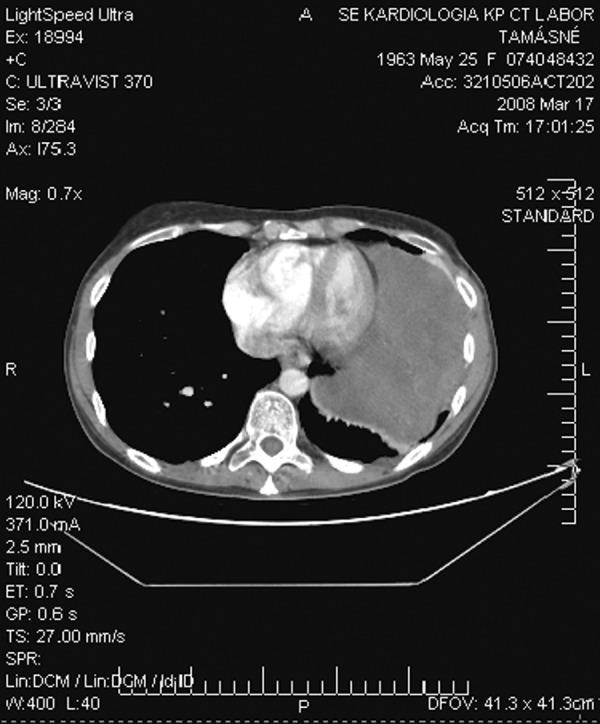 https://cdn.ncbi.nlm.nih.gov/pmc/blobs/927c/3560762/50d0b8e7946b/medscimonit-18-3-CS17-g003.jpg