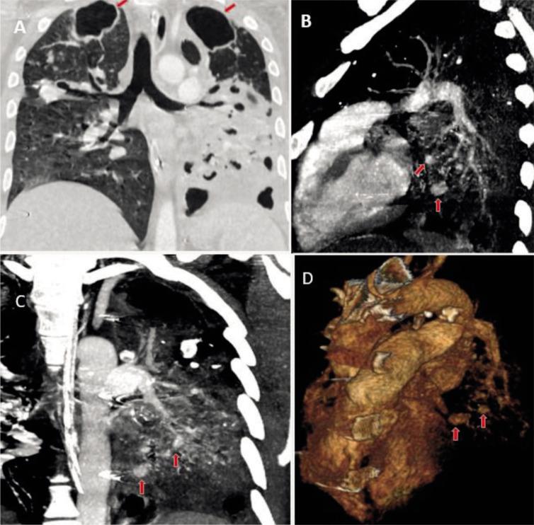 https://cdn.ncbi.nlm.nih.gov/pmc/blobs/927e/11227676/7dbf641eedd5/amed-31-194-g001.jpg