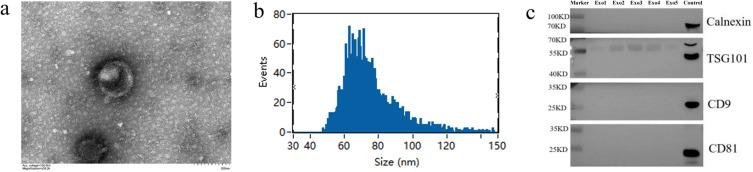 https://cdn.ncbi.nlm.nih.gov/pmc/blobs/9281/10473432/2ea159007585/JIR-16-3687-g0001.jpg