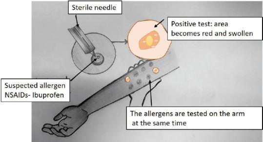 https://cdn.ncbi.nlm.nih.gov/pmc/blobs/9287/7069112/ca286511ae72/JISP-24-178-g002.jpg