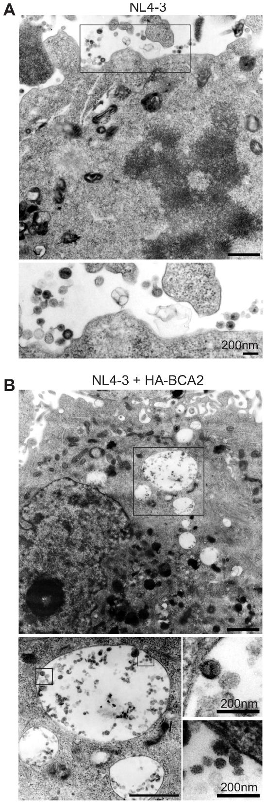 https://cdn.ncbi.nlm.nih.gov/pmc/blobs/928d/2788703/692d2bc134f1/ppat.1000700.g003.jpg