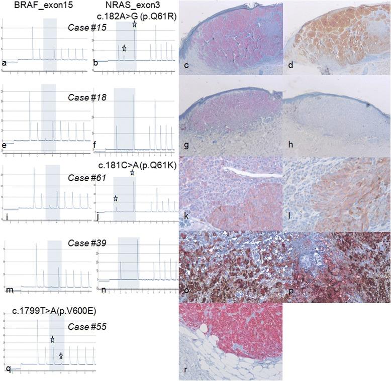 https://cdn.ncbi.nlm.nih.gov/pmc/blobs/9296/4513673/61dcc3324ef6/13000_2015_359_Fig1_HTML.jpg