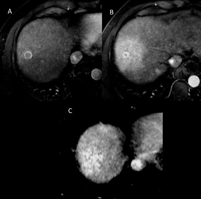 https://cdn.ncbi.nlm.nih.gov/pmc/blobs/929a/5404860/3374a76cd105/pone.0176118.g007.jpg