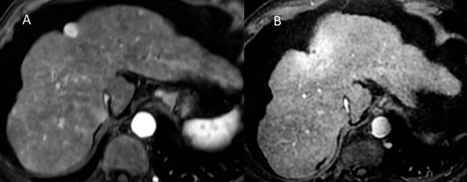 https://cdn.ncbi.nlm.nih.gov/pmc/blobs/929a/5404860/86cb13aa9e43/pone.0176118.g005.jpg