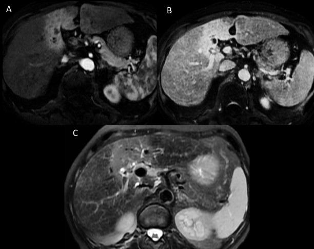 https://cdn.ncbi.nlm.nih.gov/pmc/blobs/929a/5404860/f3e7245b9363/pone.0176118.g004.jpg