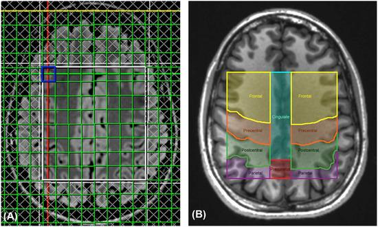 https://cdn.ncbi.nlm.nih.gov/pmc/blobs/929a/9292420/436c7c96eb85/JON-31-1099-g007.jpg