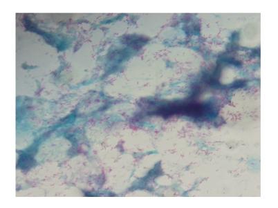 https://cdn.ncbi.nlm.nih.gov/pmc/blobs/929d/2943107/123888fd8ce3/VMI2010-321797.001.jpg