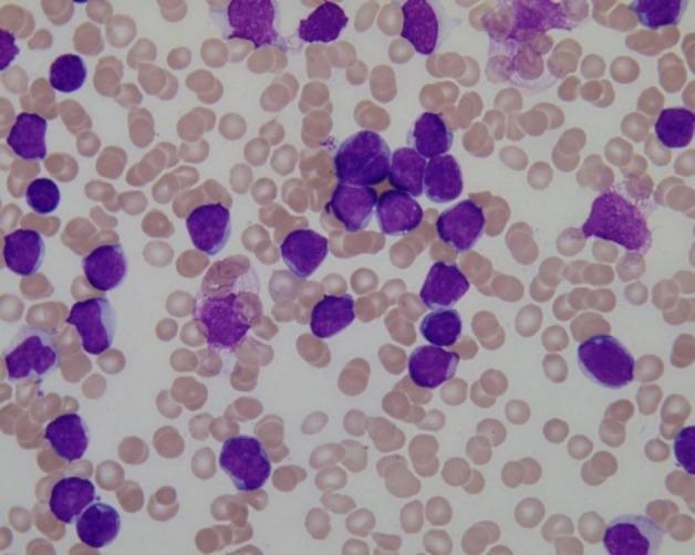 https://cdn.ncbi.nlm.nih.gov/pmc/blobs/92a3/10507331/38958a14c5be/fonc-13-1223353-g005.jpg