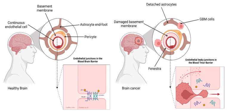 https://cdn.ncbi.nlm.nih.gov/pmc/blobs/92a3/9415007/c8bf1928cb78/pharmaceutics-14-01697-g003.jpg