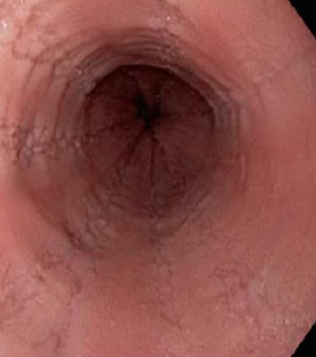 https://cdn.ncbi.nlm.nih.gov/pmc/blobs/92a8/6718043/eedbbc01cdec/WJG-25-4598-g002.jpg