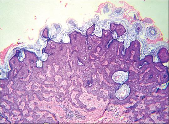 https://cdn.ncbi.nlm.nih.gov/pmc/blobs/92ac/10162735/7d5b1288acc2/IJD-68-125b-g007.jpg