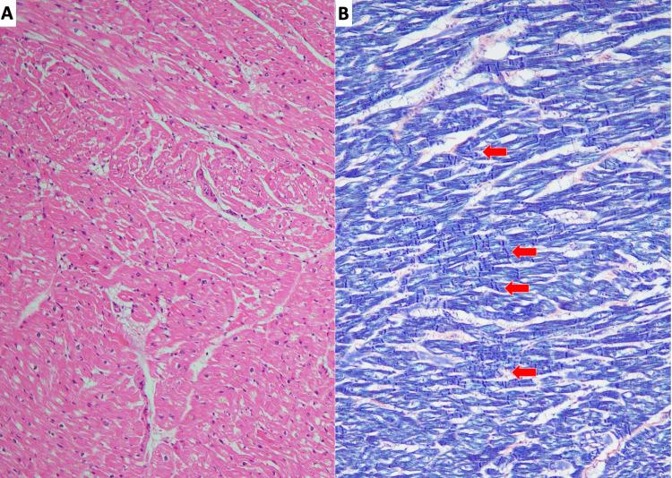 https://cdn.ncbi.nlm.nih.gov/pmc/blobs/92ad/9012600/d602e518a162/cureus-0014-00000023287-i05.jpg