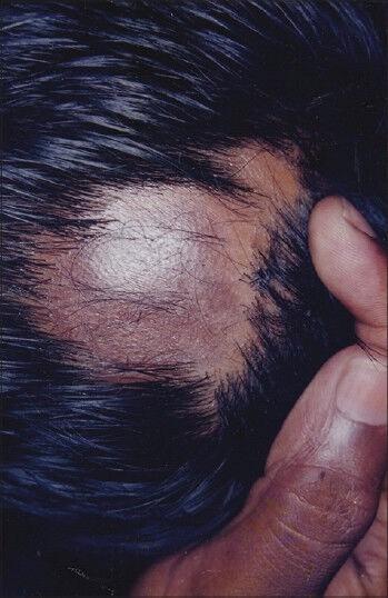 https://cdn.ncbi.nlm.nih.gov/pmc/blobs/92b3/3999646/53831e5e5cff/IJT-5-179-g015.jpg