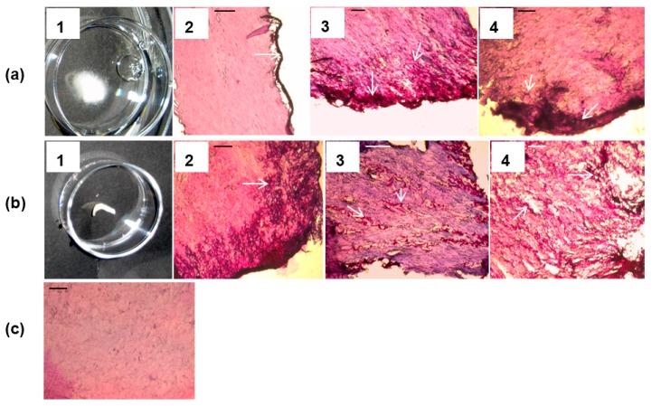 https://cdn.ncbi.nlm.nih.gov/pmc/blobs/92b3/5753106/18dcfb60ad6e/jof-01-00138-g004.jpg