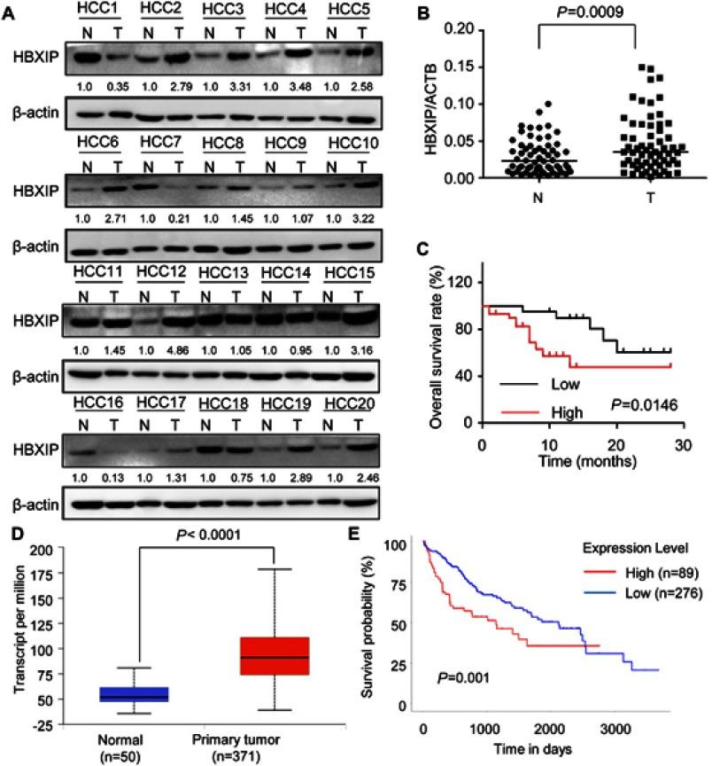 https://cdn.ncbi.nlm.nih.gov/pmc/blobs/92c5/6529033/23eccc847b15/CMAR-11-4529-g0001.jpg