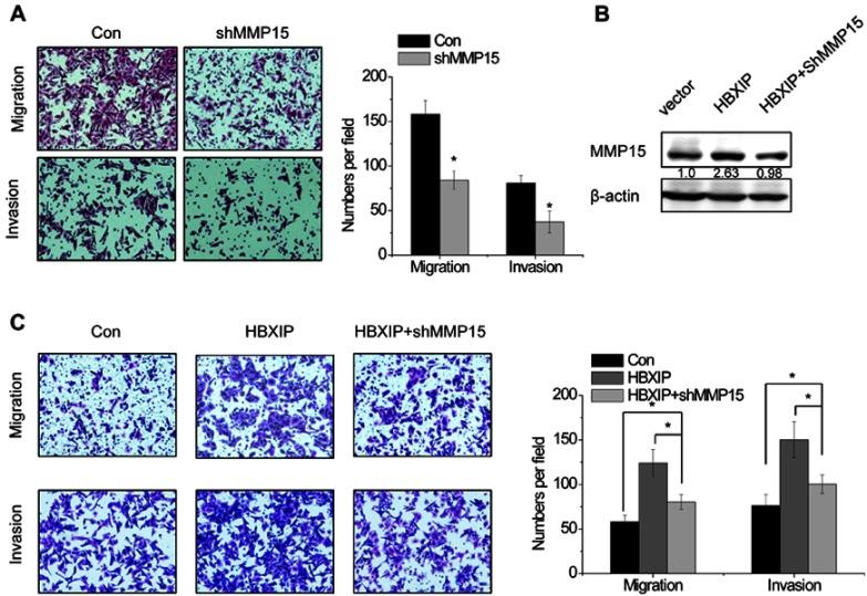 https://cdn.ncbi.nlm.nih.gov/pmc/blobs/92c5/6529033/ab05ce089158/CMAR-11-4529-g0004.jpg
