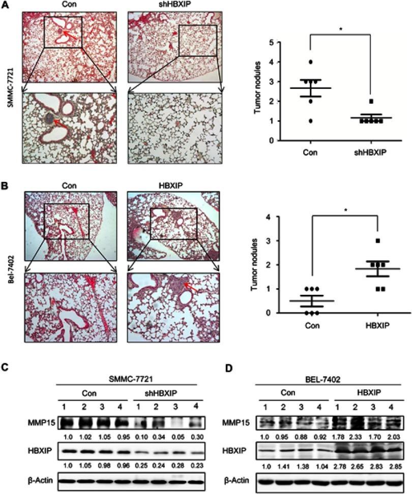 https://cdn.ncbi.nlm.nih.gov/pmc/blobs/92c5/6529033/cb13986df30a/CMAR-11-4529-g0005.jpg