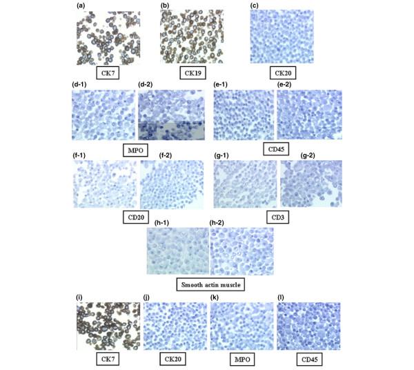 https://cdn.ncbi.nlm.nih.gov/pmc/blobs/92cd/1526588/49d962b3711e/ar1912-2.jpg