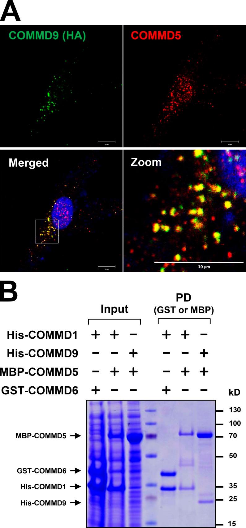 https://cdn.ncbi.nlm.nih.gov/pmc/blobs/92d1/4639872/8dc6f489ba5c/JCB_201505108_Fig6.jpg