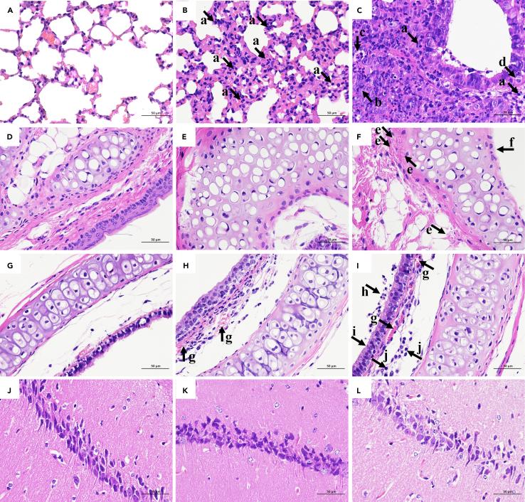 https://cdn.ncbi.nlm.nih.gov/pmc/blobs/92d2/9156949/ae047565d807/gr3.jpg