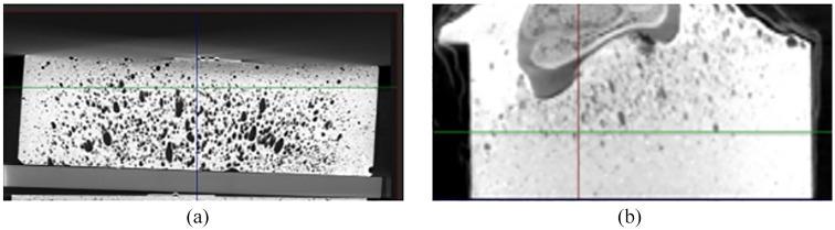 https://cdn.ncbi.nlm.nih.gov/pmc/blobs/92d5/7841704/22bddee824a3/10.1177_0954411920971071-fig5.jpg