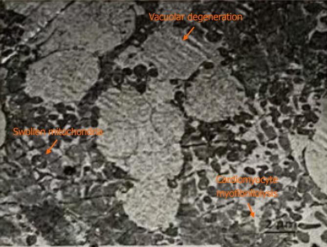 https://cdn.ncbi.nlm.nih.gov/pmc/blobs/92d9/12188839/a12fe1b0fed5/wjcc-13-22-104283-g003.jpg