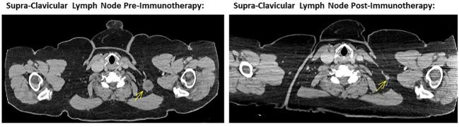 https://cdn.ncbi.nlm.nih.gov/pmc/blobs/92e0/10896602/fd174ff958eb/fonc-14-1330271-g001.jpg