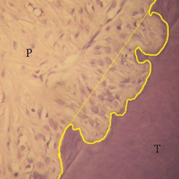 https://cdn.ncbi.nlm.nih.gov/pmc/blobs/92e0/4992183/3d5e1e348a41/Cell-J-18-271-g04.jpg