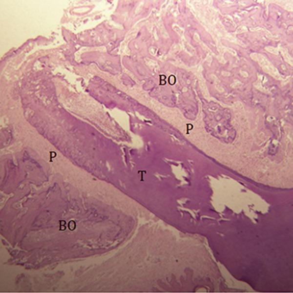https://cdn.ncbi.nlm.nih.gov/pmc/blobs/92e0/4992183/6bacc02d5613/Cell-J-18-271-g02.jpg