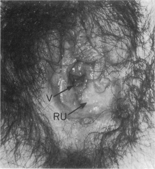 https://cdn.ncbi.nlm.nih.gov/pmc/blobs/92e8/1306251/a566fd46f339/westjmed00167-0109-b.jpg