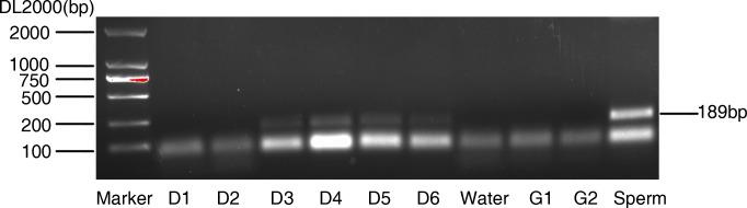https://cdn.ncbi.nlm.nih.gov/pmc/blobs/92e9/5620213/def69951ea50/oncotarget-08-67805-g001.jpg