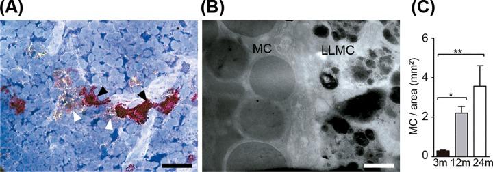 https://cdn.ncbi.nlm.nih.gov/pmc/blobs/92eb/4624951/8166170fd84c/pone.0141516.g004.jpg