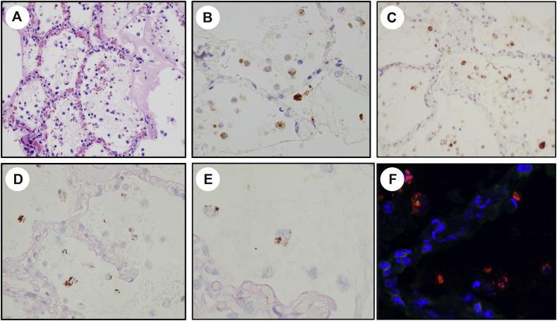 https://cdn.ncbi.nlm.nih.gov/pmc/blobs/92eb/8095022/3f568010ee60/gr2_lrg.jpg