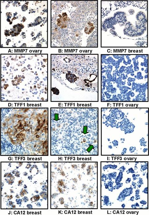 https://cdn.ncbi.nlm.nih.gov/pmc/blobs/92ec/3922375/13a1807e920b/jcmm0015-0535-f4a.jpg