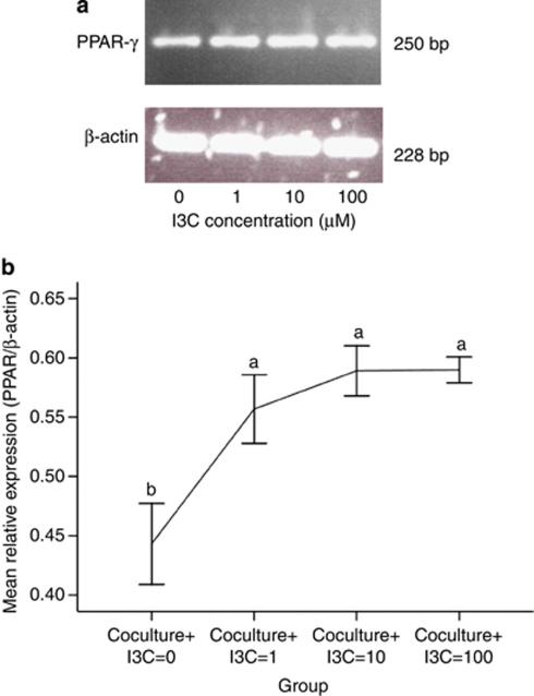 https://cdn.ncbi.nlm.nih.gov/pmc/blobs/92f7/3238050/3ede50b2fc9d/ijo201112f4.jpg