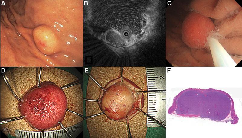 https://cdn.ncbi.nlm.nih.gov/pmc/blobs/92f7/9575717/0e52eb06bf93/medi-101-e31072-g001.jpg