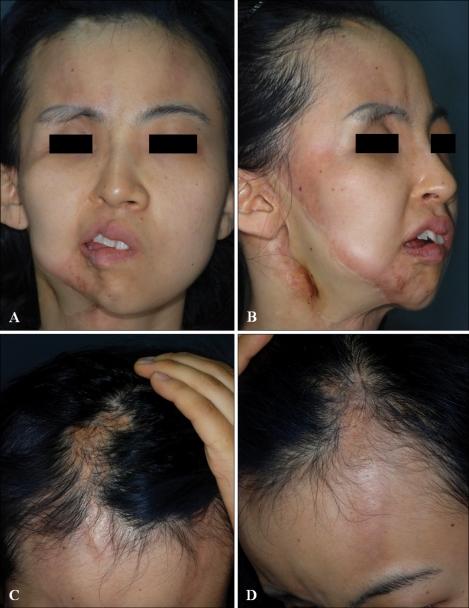 https://cdn.ncbi.nlm.nih.gov/pmc/blobs/92f8/3162264/979cab453563/ad-23-342-g004.jpg