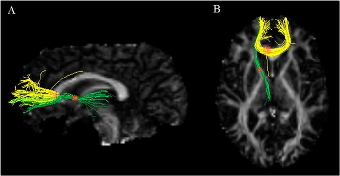 https://cdn.ncbi.nlm.nih.gov/pmc/blobs/92fc/4764827/6009ca2ec18a/srep21825-f3.jpg