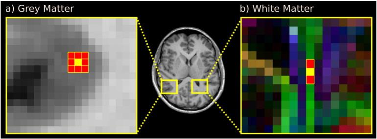 https://cdn.ncbi.nlm.nih.gov/pmc/blobs/92ff/4528070/5acaa430de70/gr1.jpg