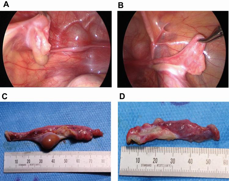 https://cdn.ncbi.nlm.nih.gov/pmc/blobs/9302/8063244/531ba47889e6/dgaa948f0003.jpg