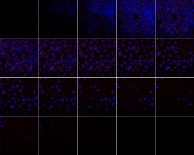 https://cdn.ncbi.nlm.nih.gov/pmc/blobs/9305/3495574/3aec2aa066a0/mp-2012-00435x_0011.jpg