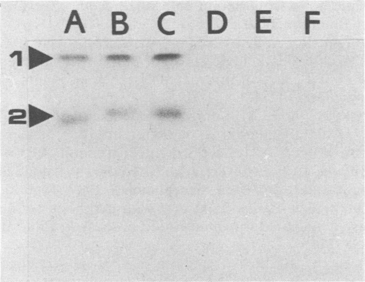 https://cdn.ncbi.nlm.nih.gov/pmc/blobs/930a/267547/13965b7a032c/jcm00066-0185-a.jpg